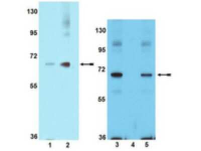 Western Blot: PAK1 [p Ser204] Antibody [NBP2-29665]